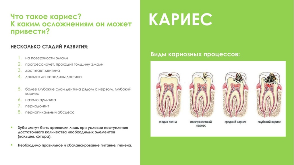 Слайд6.JPG